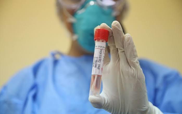 Madre de Dios: analizan presunto caso de coronavirus de jueza que estuvo en España