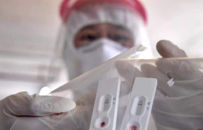 750 pruebas rápidas y 100 moleculares llegaron a Madre de Dios