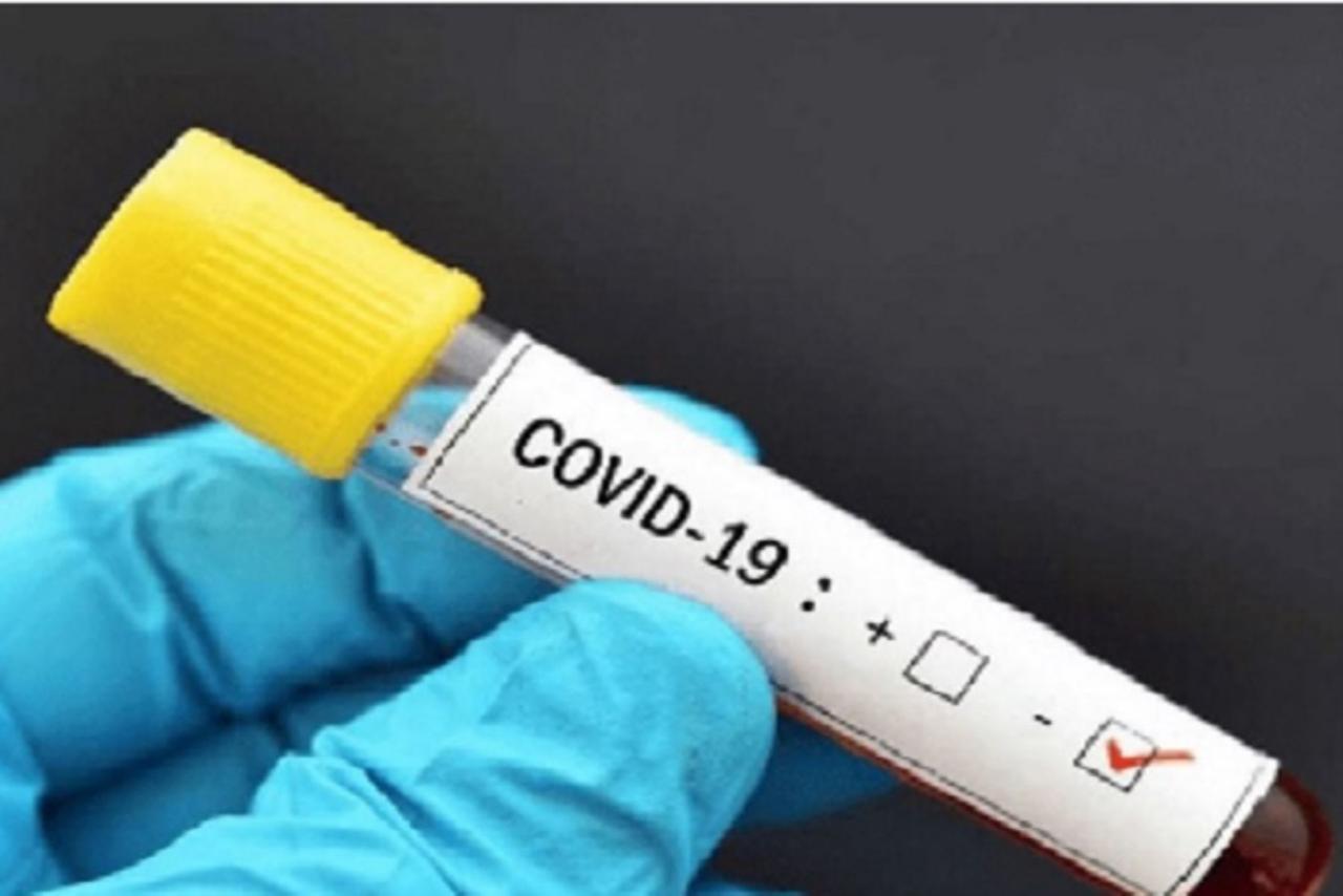 Coronavirus: 82 fallecidos en Madre de Dios y nuevos casos registrados en el Manu