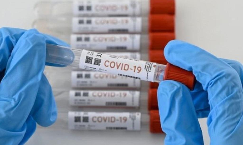 Se eleva a 165 los casos positivos de Covid-19 en Madre de Dios